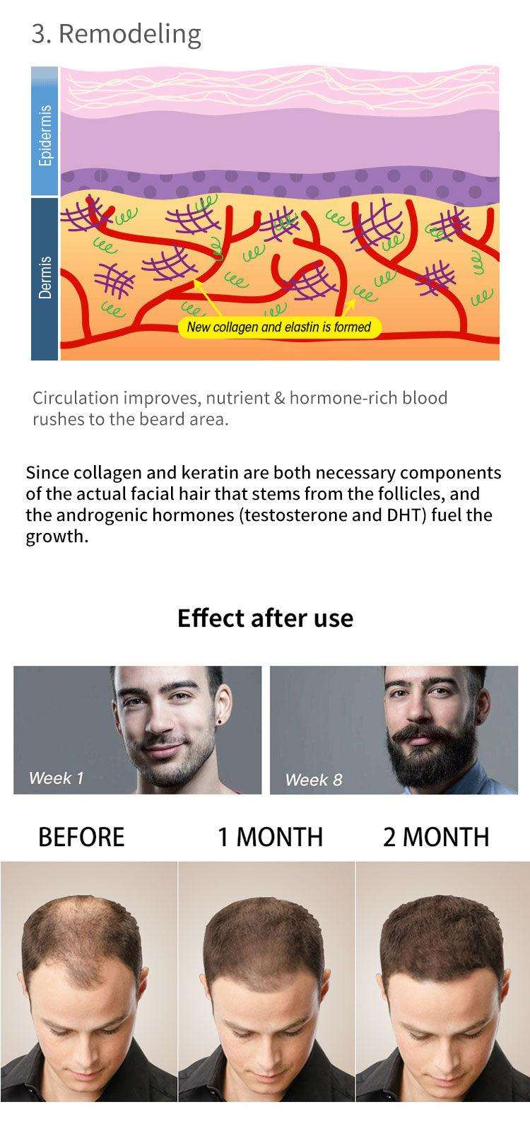 Beard Growth Kit - Premium Men - Just €49.95! Shop now at San Rocco Italia